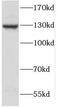 Sperm Antigen With Calponin Homology And Coiled-Coil Domains 1 Like antibody, FNab02224, FineTest, Western Blot image 