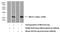 Ninjurin 2 antibody, 14085-1-AP, Proteintech Group, Western Blot image 
