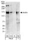ANILLIN antibody, A301-406A, Bethyl Labs, Western Blot image 