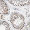 Zinc phosphodiesterase ELAC protein 2 antibody, NBP1-84620, Novus Biologicals, Immunohistochemistry paraffin image 