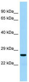 AKT1 Substrate 1 antibody, TA346510, Origene, Western Blot image 