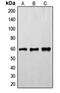 FYN Proto-Oncogene, Src Family Tyrosine Kinase antibody, MBS820634, MyBioSource, Western Blot image 