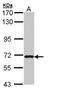 RAS Guanyl Releasing Protein 2 antibody, LS-C109417, Lifespan Biosciences, Western Blot image 