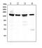 Structural Maintenance Of Chromosomes 3 antibody, M01930-1, Boster Biological Technology, Western Blot image 