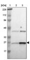 Adenylate Kinase 1 antibody, PA5-52297, Invitrogen Antibodies, Western Blot image 
