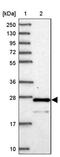 Chromosome 6 Open Reading Frame 203 antibody, PA5-62000, Invitrogen Antibodies, Western Blot image 
