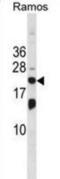 Interferon Stimulated Exonuclease Gene 20 antibody, abx028929, Abbexa, Western Blot image 