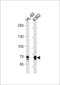 E74 Like ETS Transcription Factor 4 antibody, 62-712, ProSci, Western Blot image 