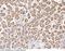 Zinc finger protein DPF3 antibody, 102918-T08, Sino Biological, Immunohistochemistry paraffin image 