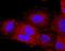VEGF co-regulated chemokine 1 antibody, MA5-24157, Invitrogen Antibodies, Immunocytochemistry image 