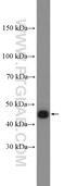 Proteasome 26S Subunit, Non-ATPase 11 antibody, 14786-1-AP, Proteintech Group, Western Blot image 