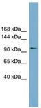 Cap Methyltransferase 2 antibody, TA344872, Origene, Western Blot image 