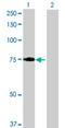 Leucine Rich Repeats And Calponin Homology Domain Containing 3 antibody, H00084859-B01P, Novus Biologicals, Western Blot image 