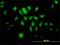 Metastasis Associated 1 antibody, H00009112-M02, Novus Biologicals, Immunofluorescence image 