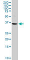 Vasohibin 1 antibody, LS-B9426, Lifespan Biosciences, Western Blot image 