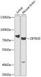 Zinc finger and BTB domain-containing protein 20 antibody, 23-318, ProSci, Western Blot image 