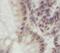 Period Circadian Regulator 3 antibody, FNab06313, FineTest, Immunohistochemistry paraffin image 
