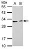Cell death activator CIDE-3 antibody, NBP2-15903, Novus Biologicals, Western Blot image 
