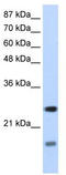 Signal Recognition Particle 14 antibody, TA345831, Origene, Western Blot image 