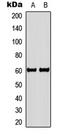 LYN Proto-Oncogene, Src Family Tyrosine Kinase antibody, LS-C368407, Lifespan Biosciences, Western Blot image 