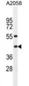 Major Histocompatibility Complex, Class I, B antibody, abx025843, Abbexa, Western Blot image 