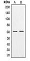 Chondroitin Sulfate N-Acetylgalactosaminyltransferase 1 antibody, LS-C353487, Lifespan Biosciences, Western Blot image 