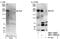 PHIP antibody, NBP1-19096, Novus Biologicals, Western Blot image 