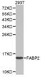 Fatty Acid Binding Protein 2 antibody, TA327107, Origene, Western Blot image 
