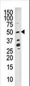 Dual specificity protein phosphatase 10 antibody, LS-C101039, Lifespan Biosciences, Western Blot image 
