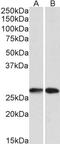 Nicotinamide N-Methyltransferase antibody, TA341384, Origene, Western Blot image 