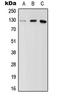 Myosin Binding Protein C, Fast Type antibody, LS-C353753, Lifespan Biosciences, Western Blot image 
