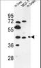 Pregnancy Specific Beta-1-Glycoprotein 3 antibody, LS-B9903, Lifespan Biosciences, Western Blot image 