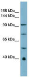 RB Binding Protein 6, Ubiquitin Ligase antibody, TA329803, Origene, Western Blot image 
