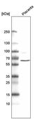 Adhesion G Protein-Coupled Receptor L4 antibody, MA5-24705, Invitrogen Antibodies, Western Blot image 