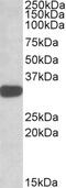 Homeobox A9 antibody, 42-585, ProSci, Enzyme Linked Immunosorbent Assay image 