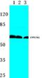 Cytochrome P450 Family 17 Subfamily A Member 1 antibody, AP06771PU-N, Origene, Western Blot image 