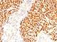 Myogenin antibody, V3153IHC-7ML, NSJ Bioreagents, Immunohistochemistry paraffin image 