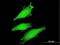 F-Box And WD Repeat Domain Containing 11 antibody, H00023291-M03, Novus Biologicals, Immunofluorescence image 