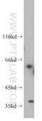 Adenosine Deaminase Domain Containing 2 antibody, 21217-1-AP, Proteintech Group, Western Blot image 