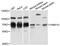 FKBP Prolyl Isomerase 10 antibody, LS-C748001, Lifespan Biosciences, Western Blot image 