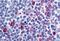 C-C chemokine receptor type 8 antibody, GTX78049, GeneTex, Immunohistochemistry paraffin image 