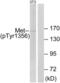 c-met antibody, LS-C199257, Lifespan Biosciences, Western Blot image 