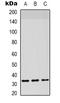 Coagulation Factor III, Tissue Factor antibody, orb339106, Biorbyt, Western Blot image 