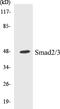 SMAD Family Member 3 antibody, EKC1528, Boster Biological Technology, Western Blot image 