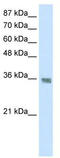Heterogeneous Nuclear Ribonucleoprotein A1 antibody, TA345791, Origene, Western Blot image 