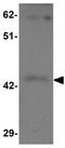Protein shisa-9 antibody, GTX85137, GeneTex, Western Blot image 