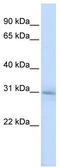 Methyltransferase Like 5 antibody, TA334496, Origene, Western Blot image 