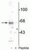 Syntaxin-binding protein 2 antibody, P04909, Boster Biological Technology, Western Blot image 