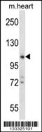 Zinc Finger CCHC-Type Containing 14 antibody, 57-179, ProSci, Western Blot image 