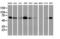 Epsin 2 antibody, M08001, Boster Biological Technology, Western Blot image 